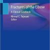 Fractures of the Elbow: A Clinical Casebook 1st ed. 2019 Edition