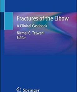 Fractures of the Elbow: A Clinical Casebook 1st ed. 2019 Edition