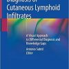 Diagnosis of Cutaneous Lymphoid Infiltrates: A Visual Approach to Differential Diagnosis and Knowledge Gaps 1st ed. 2019 Edition