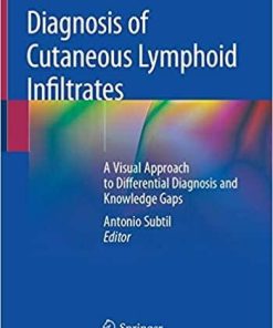 Diagnosis of Cutaneous Lymphoid Infiltrates: A Visual Approach to Differential Diagnosis and Knowledge Gaps 1st ed. 2019 Edition