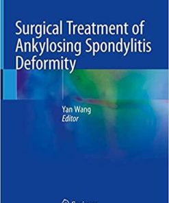 Surgical Treatment of Ankylosing Spondylitis Deformity 1st ed. 2019 Edition