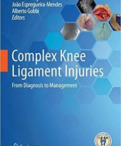 Complex Knee Ligament Injuries: From Diagnosis to Management 1st ed. 2019 Edition