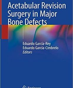 Acetabular Revision Surgery in Major Bone Defects 1st ed. 2019 Edition