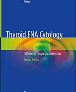 Thyroid FNA Cytology: Differential Diagnoses and Pitfalls 2nd ed. 2019 Edition