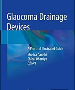 Glaucoma Drainage Devices: A Practical Illustrated Guide 1st ed. 2019 Edition