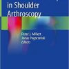 Advanced Techniques in Shoulder Arthroscopy 1st ed. 2019 Edition