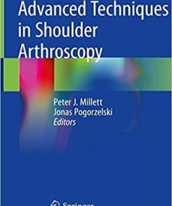 Advanced Techniques in Shoulder Arthroscopy 1st ed. 2019 Edition