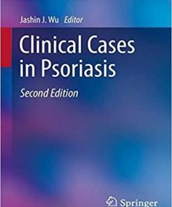 Clinical Cases in Psoriasis (Clinical Cases in Dermatology) 2nd ed. 2019 Edition