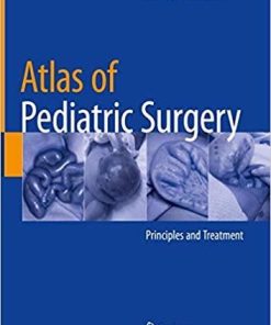 Atlas of Pediatric Surgery: Principles and Treatment 1st ed. 2020 Edition