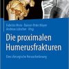 Die proximalen Humerusfrakturen: Eine chirurgische Herausforderung (German Edition) (German) 1. Aufl. 2020 Edition