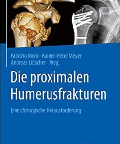 Die proximalen Humerusfrakturen: Eine chirurgische Herausforderung (German Edition) (German) 1. Aufl. 2020 Edition