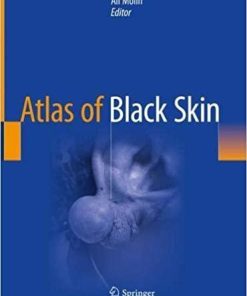 Atlas of Black Skin 1st ed. 2020 Edition