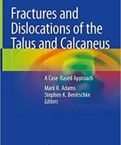 Fractures and Dislocations of the Talus and Calcaneus: A Case-Based Approach 1st ed. 2020 Edition