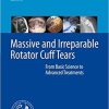 Massive and Irreparable Rotator Cuff Tears: From Basic Science to Advanced Treatments 1st ed. 2020 Edition