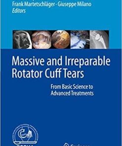 Massive and Irreparable Rotator Cuff Tears: From Basic Science to Advanced Treatments 1st ed. 2020 Edition