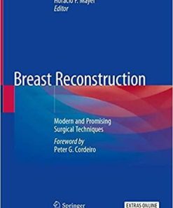 Breast Reconstruction: Modern and Promising Surgical Techniques 1st ed. 2020 Edition