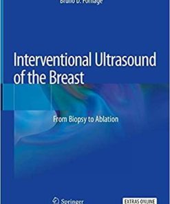 Interventional Ultrasound of the Breast: From Biopsy to Ablation 1st ed. 2020 Edition