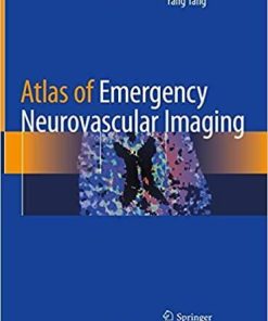 Atlas of Emergency Neurovascular Imaging 1st ed. 2020 Edition