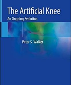 The Artificial Knee: An Ongoing Evolution 1st ed. 2020 Edition