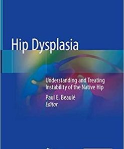 Hip Dysplasia: Understanding and Treating Instability of the Native Hip 1st ed. 2020 Edition