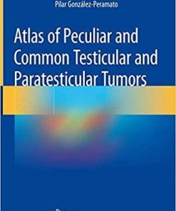 Atlas of Peculiar and Common Testicular and Paratesticular Tumors 1st ed. 2020 Edition