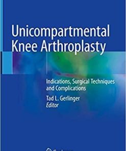 Unicompartmental Knee Arthroplasty: Indications, Surgical Techniques and Complications 1st ed. 2020 Edition