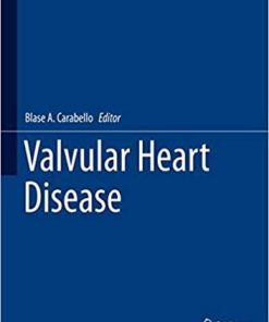 Valvular Heart Disease (Cardiovascular Medicine) 1st ed. 2020 Edition