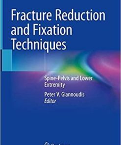 Fracture Reduction and Fixation Techniques: Spine-Pelvis and Lower Extremity 1st ed. 2020 Edition