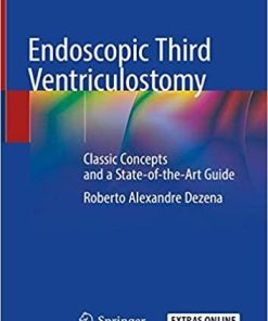 Endoscopic Third Ventriculostomy: Classic Concepts and a State-of-the-Art Guide Hardcover – October 11, 2019