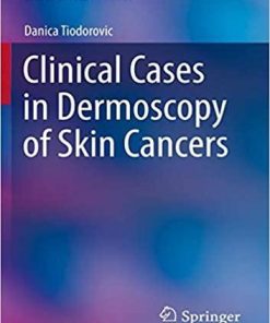 Clinical Cases in Dermoscopy of Skin Cancers (Clinical Cases in Dermatology) 1st ed. 2020 Edition