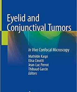 Eyelid and Conjunctival Tumors: In Vivo Confocal Microscopy 1st ed. 2020 Edition