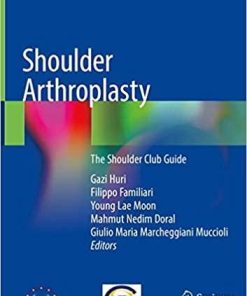 Shoulder Arthroplasty: The Shoulder Club Guide 1st ed. 2020 Edition