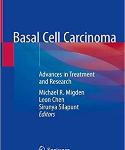 Basal Cell Carcinoma: Advances in Treatment and Research 1st ed. 2020 Edition