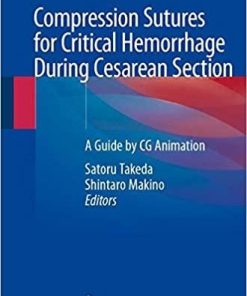 Compression Sutures for Critical Hemorrhage During Cesarean Section: A Guide by CG Animation 1st ed. 2020 Edition