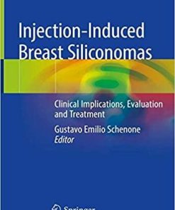 Injection-Induced Breast Siliconomas: Clinical Implications, Evaluation and Treatment 1st ed. 2020 Edition