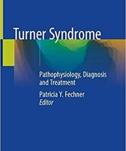 Turner Syndrome: Pathophysiology, Diagnosis and Treatment 1st ed. 2020 Edition