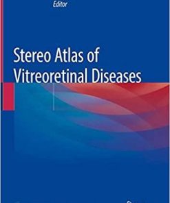 Stereo Atlas of Vitreoretinal Diseases 1st ed. 2020 Edition