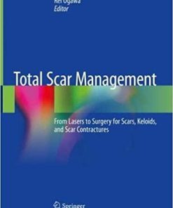 Total Scar Management: From Lasers to Surgery for Scars, Keloids, and Scar Contractures 1st ed. 2020 Edition