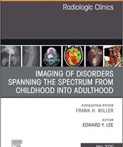 Imaging of Disorders Spanning the Spectrum from Childhood ,An Issue of Radiologic Clinics of North America (Volume 58-3) (The Clinics: Radiology (Volume 58-3))