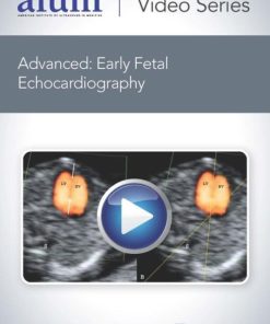 AIUM Advanced: Early Fetal Echocardiography (CME VIDEOS)