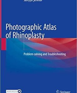 Photographic Atlas of Rhinoplasty: Problem-solving and Troubleshooting 1st ed. 2021