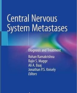 Central Nervous System Metastases: Diagnosis and Treatment 1st ed. 2020 Edition