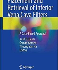 Placement and Retrieval of Inferior Vena Cava Filters: A Case-Based Approach 1st ed. 2020 Edition