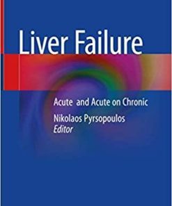 Liver Failure: Acute and Acute on Chronic 1st ed. 2020 Edition