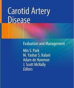 Carotid Artery Disease: Evaluation and Management 1st ed. 2020 Edition