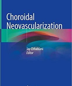 Choroidal Neovascularization 1st ed. 2020 Edition