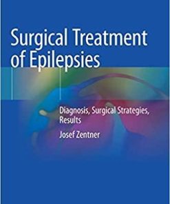 Surgical Treatment of Epilepsies: Diagnosis, Surgical Strategies, Results 1st ed. 2020 Edition