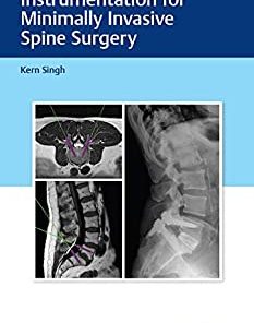 Instrumentation for Minimally Invasive Spine Surgery (PDF)