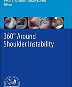 360° Around Shoulder Instability