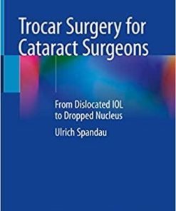 Trocar Surgery for Cataract Surgeons: From Dislocated IOL to Dropped Nucleus 1st ed. 2020 Edition